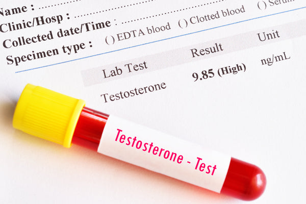 Can You Boost Testosterone Naturally?